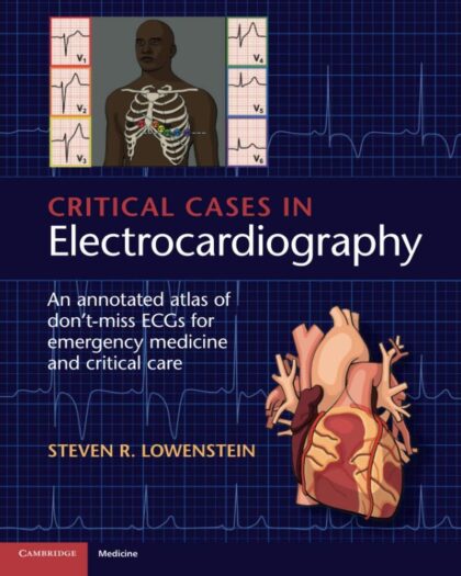 Critical Cases in Electrocardiography: An Annotated Atlas of Don’t-Miss ECGs for Emergency Medicine and Critical Care