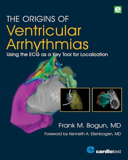 The Origins of Ventricular Arrhythmias Using the ECG as a Key Tool for Localization Volume 1
