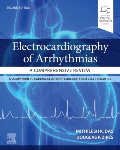 Electrocardiography of Arrhythmias: A Comprehensive Review E-Book: A Companion to Cardiac Electrophysiology