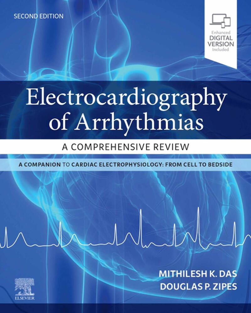 Electrocardiography of Arrhythmias: A Comprehensive Review E-Book: A Companion to Cardiac Electrophysiology