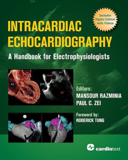 Intracardiac Echocardiography: A Handbook for Electrophysiologists: A Handbook for Electrophysiologists
