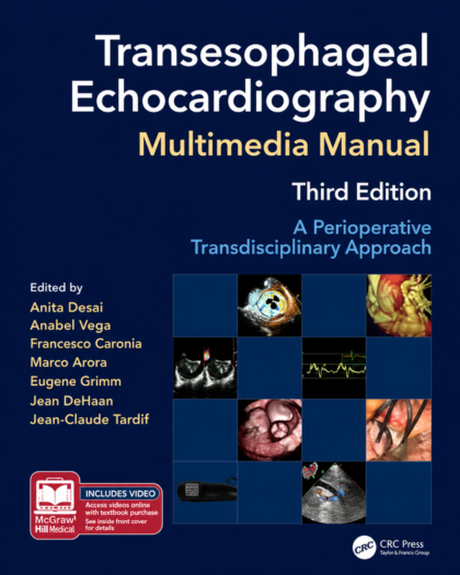 Transesophageal Echocardiography Multimedia Manual: A Perioperative Transdisciplinary Approach