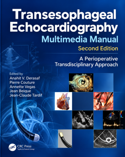 Transesophageal Echocardiography Multimedia Manual: A Perioperative Transdisciplinary Approach