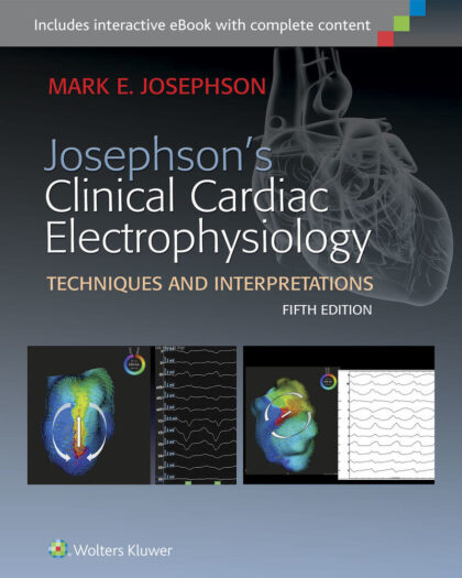 Clinical Cardiac Electrophysiology Techniques and Interpretations