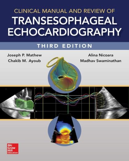 Clinical Manual and Review of Transesophageal Echocardiography,